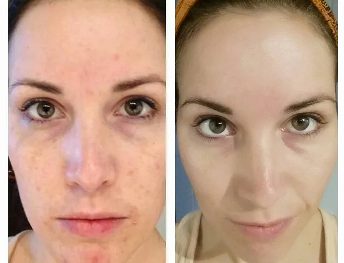 See the Difference<em> Pure Ingredients </em>Make