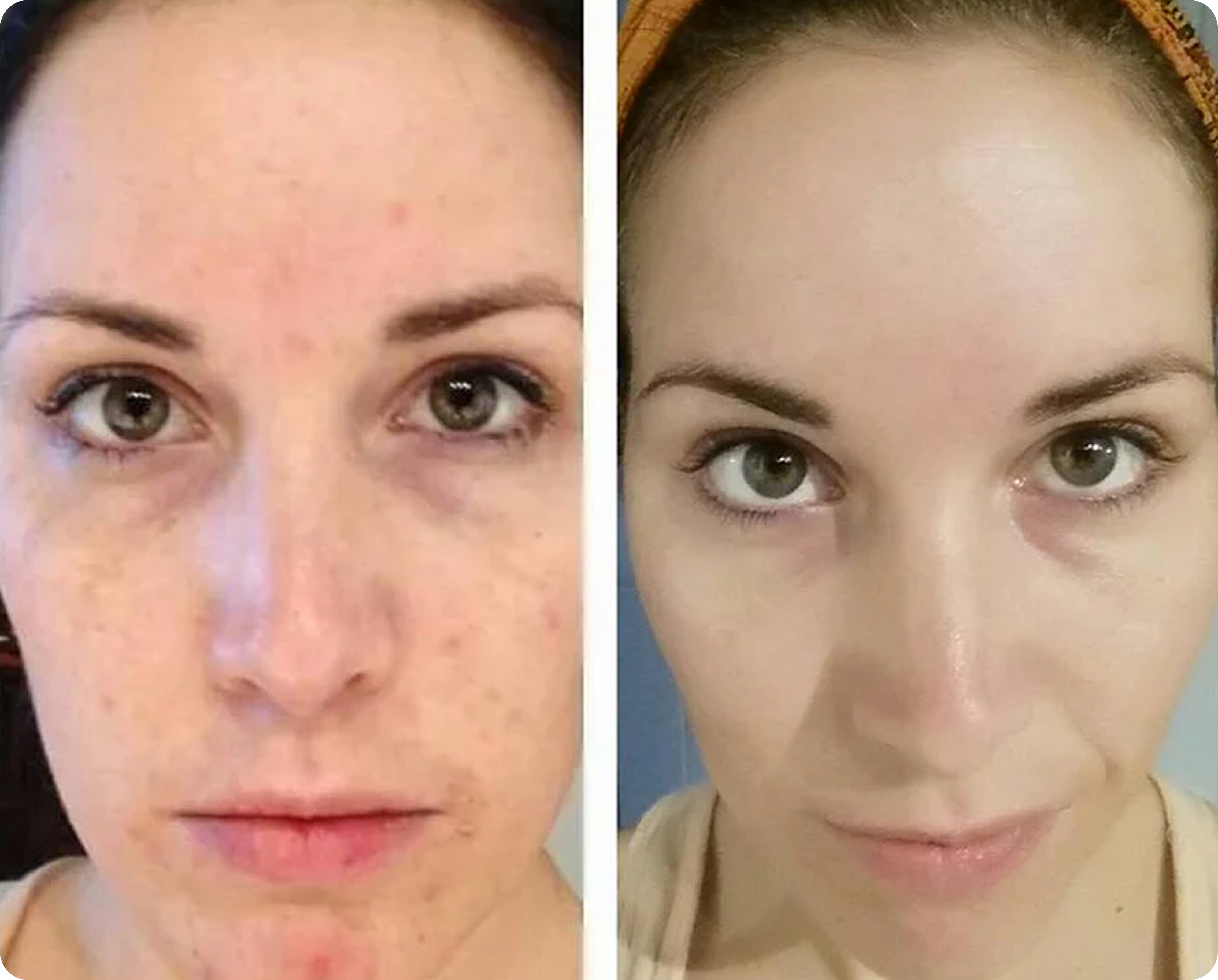 <p>See the Difference <em>Simplicity</em> Makes</p>