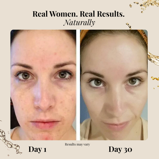 The Hippie Skin Starter Kit